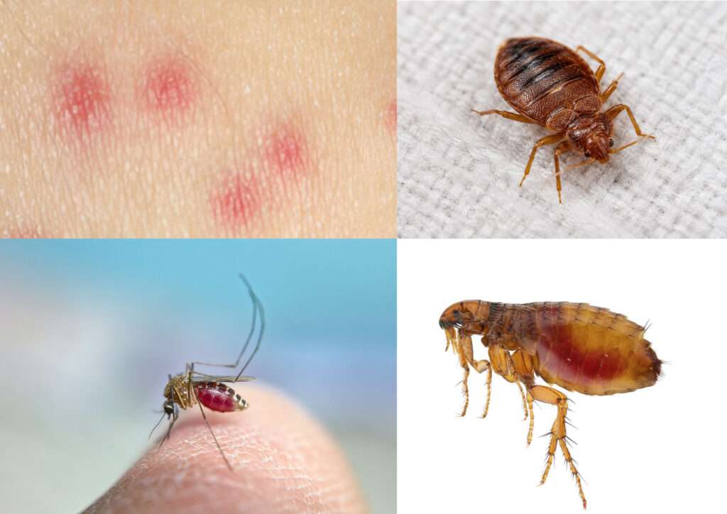 vyrážka jako štípance od komára, svedive stipance jako od komara, stipance jako od komara, jak vypadá kousnutí od blechy foto